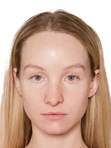 After photo transformation